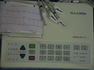  Avisos gratis en Mexico lindo en Nogales |  ELECTROCARDIOGRAFO AT 1 , WELCH  ALLYN  SCHILLER