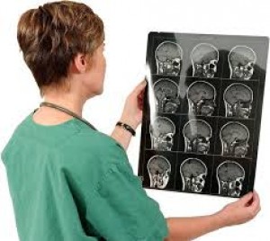 Arturo Molina Avisos gratis en Mexico lindo en Guadalajara |  Neurologos en guadalajara jalisco, neurologo en guadalajara, Medico neurologo, neurologia en guadalajara